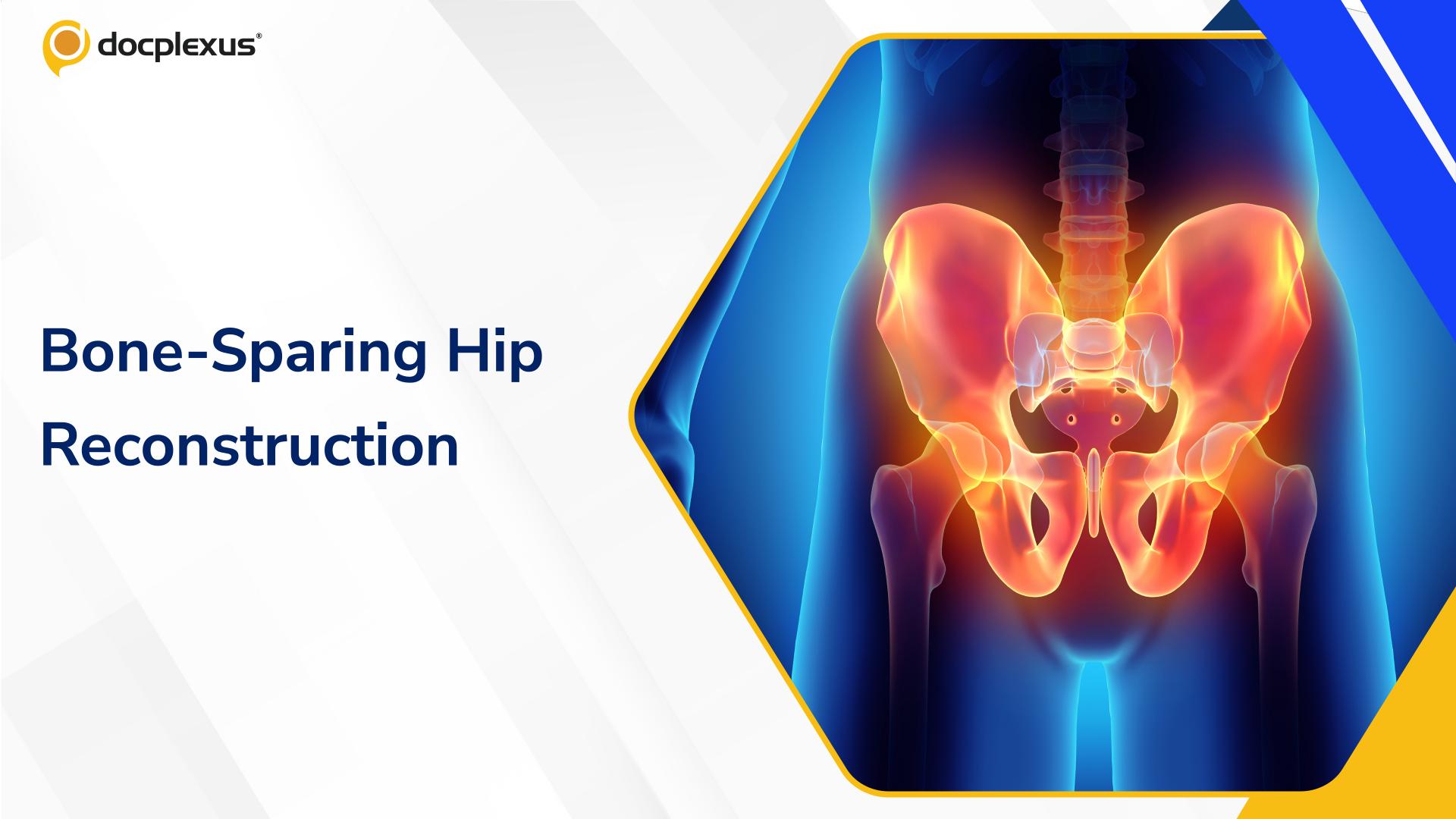 Bone-Sparing Hip Reconstruction Reported as First in Asia