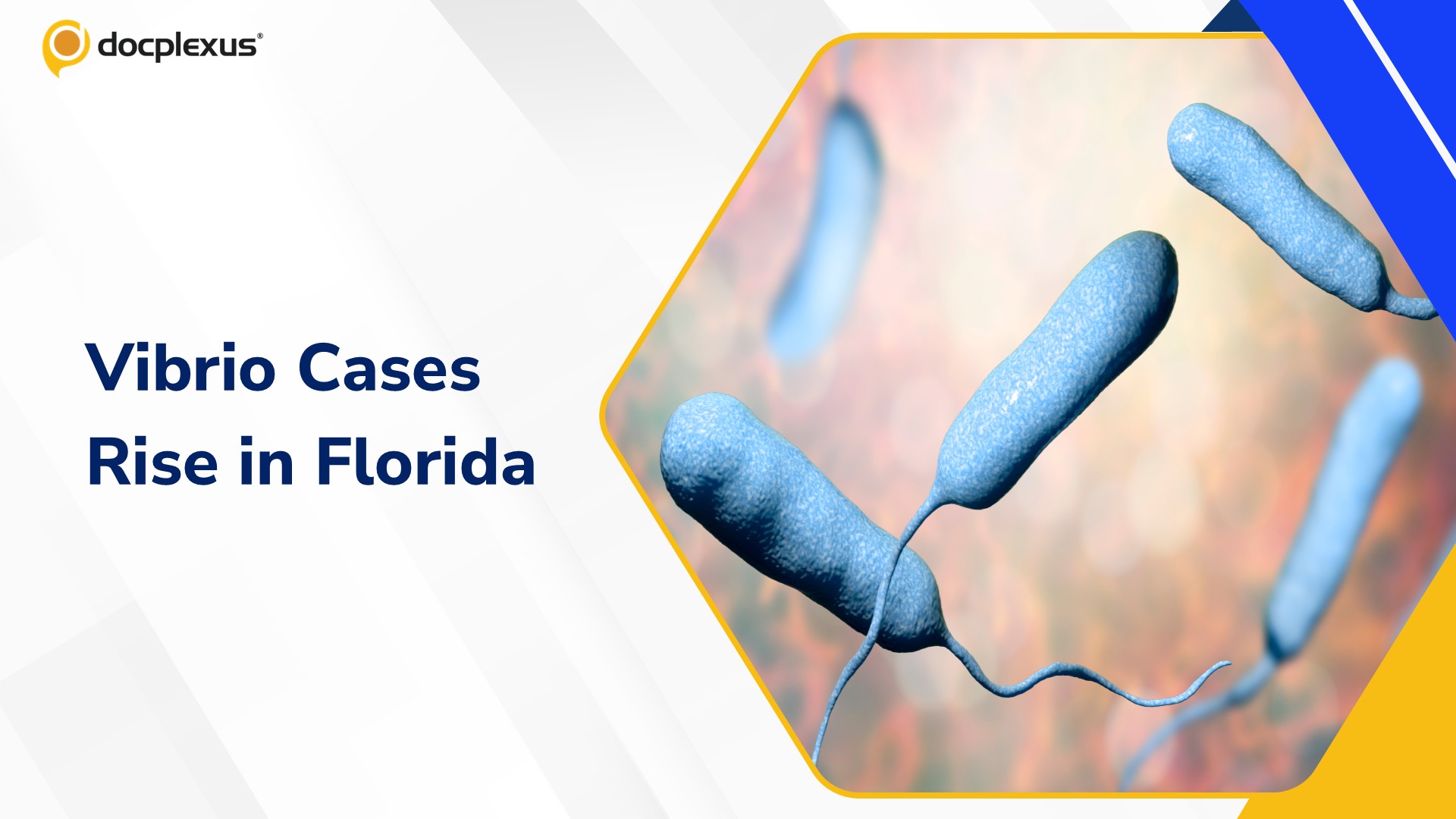 Florida Reports 22 Vibrio vulnificus Cases and Four Deaths in 2026