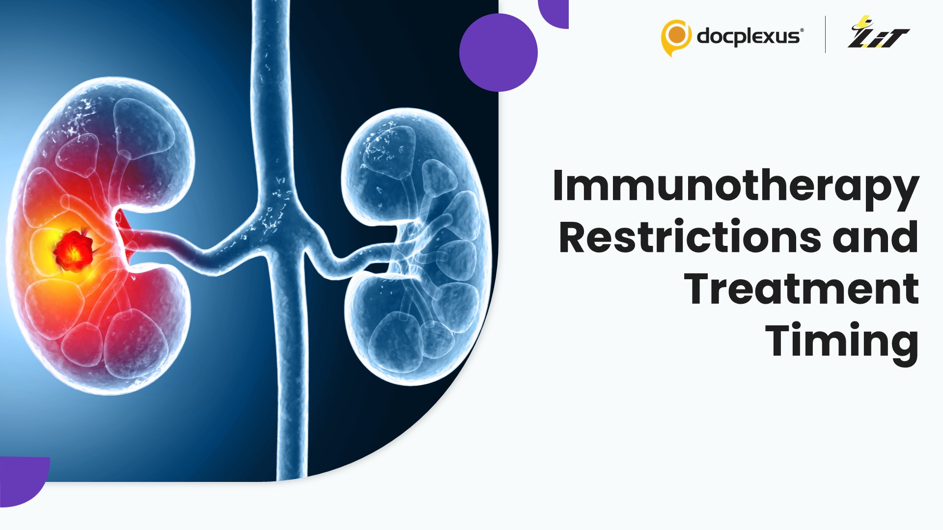 Immunotherapy Prescribing Restrictions Changed Treatment Timing in Metastatic Clear Cell Renal Carcinoma