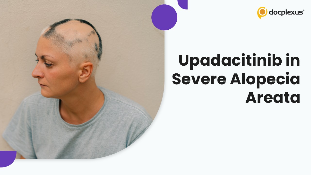 Hair Regrowth Realized: Phase 3 Trials Establish Upadacitinib Efficacy in Severe Alopecia Areata