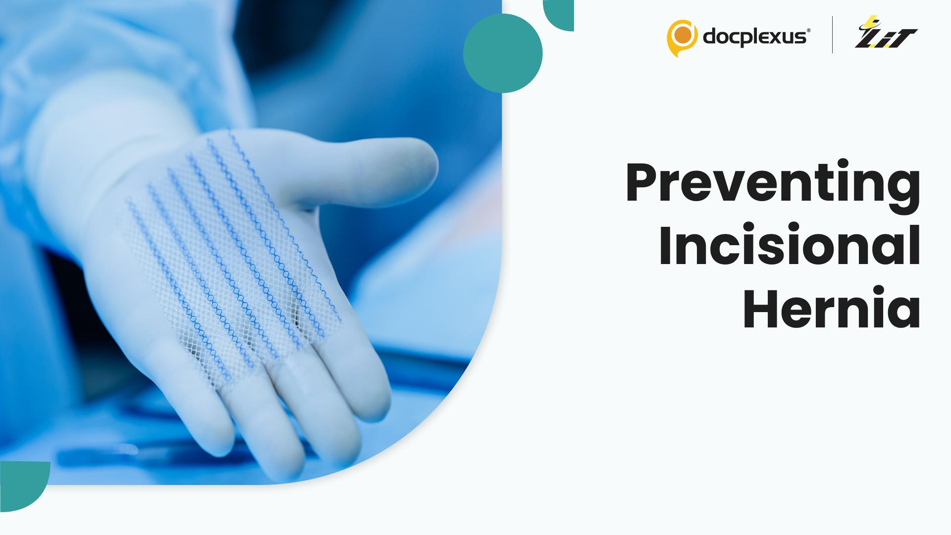 Can Prophylactic Mesh Prevent Incisional Hernia?