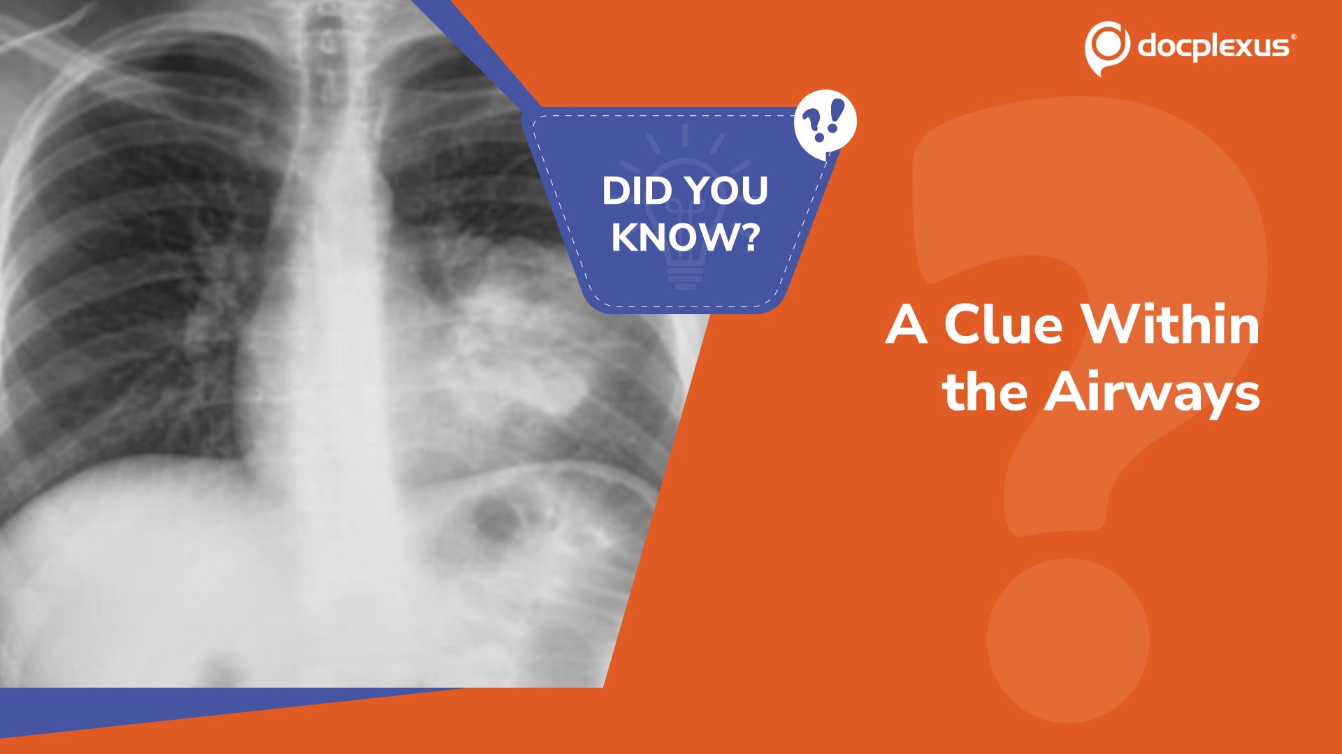 What Is the Significance of This CT Finding?