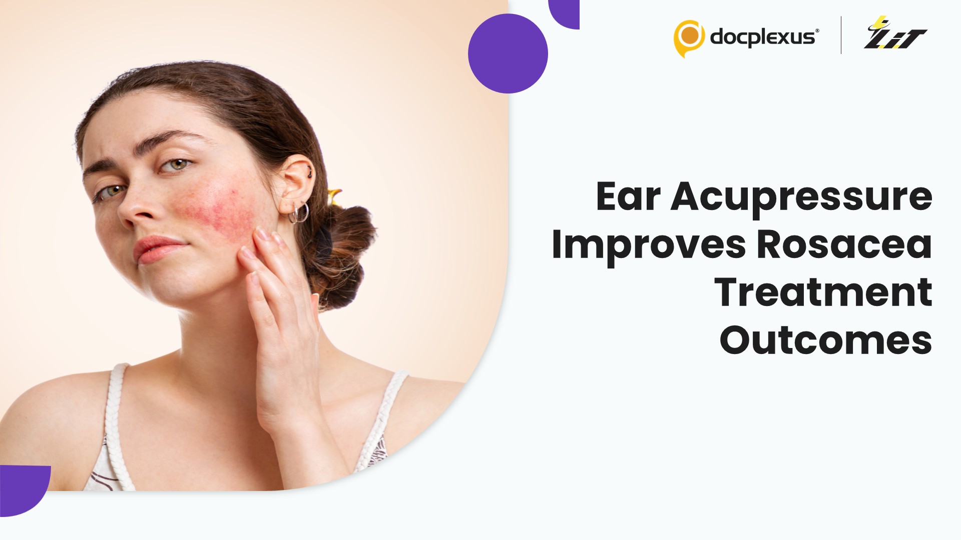 Device-Free Auricular Acupressure Improves Rosacea Outcomes in a Randomized Trial