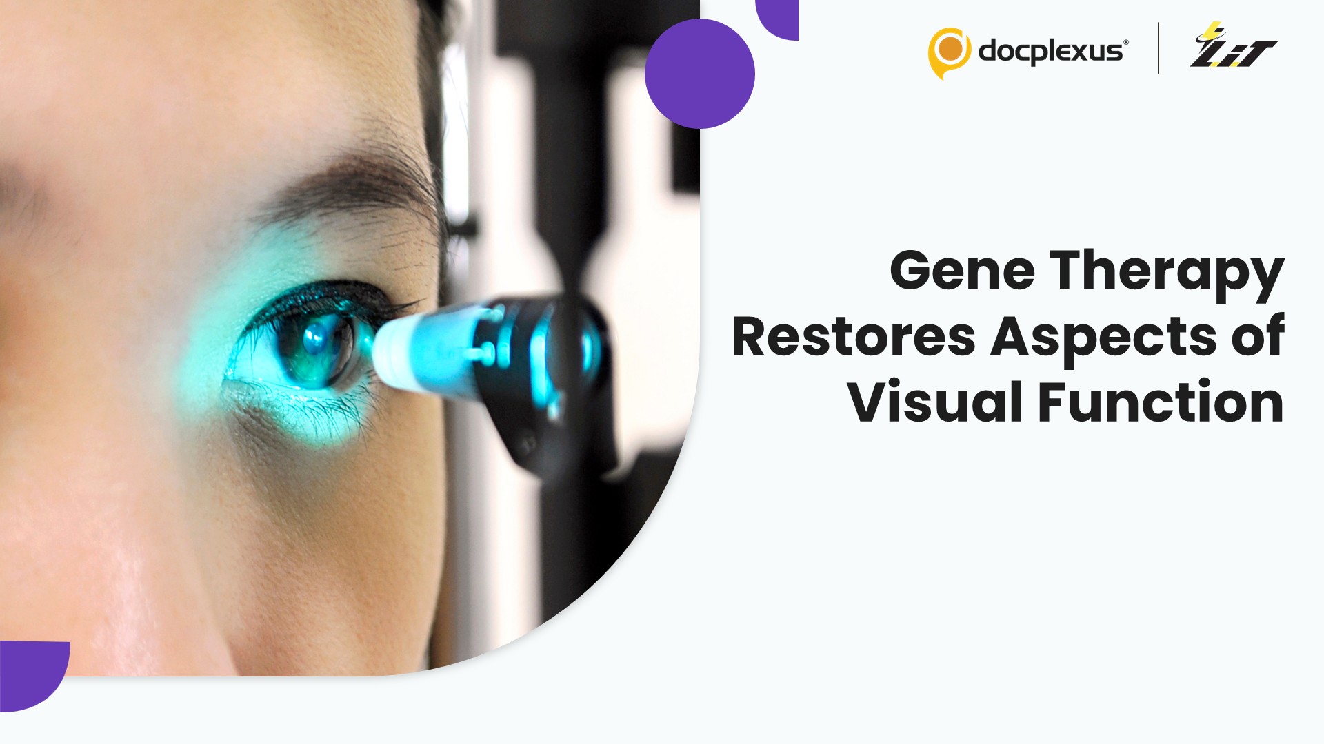 Optogenetic Therapy Improves Light Sensitivity in Advanced Retinitis Pigmentosa