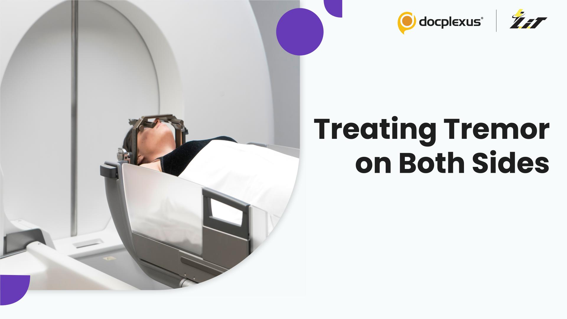 Staged Bilateral Gamma Knife Radiosurgery for Severe Essential Tremor