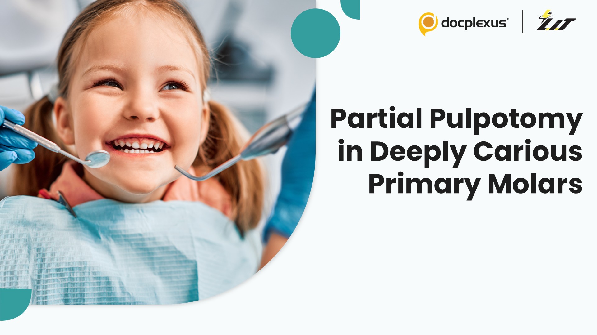 Partial Versus Full Pulpotomy in Primary Molars: 12-Month Outcomes
