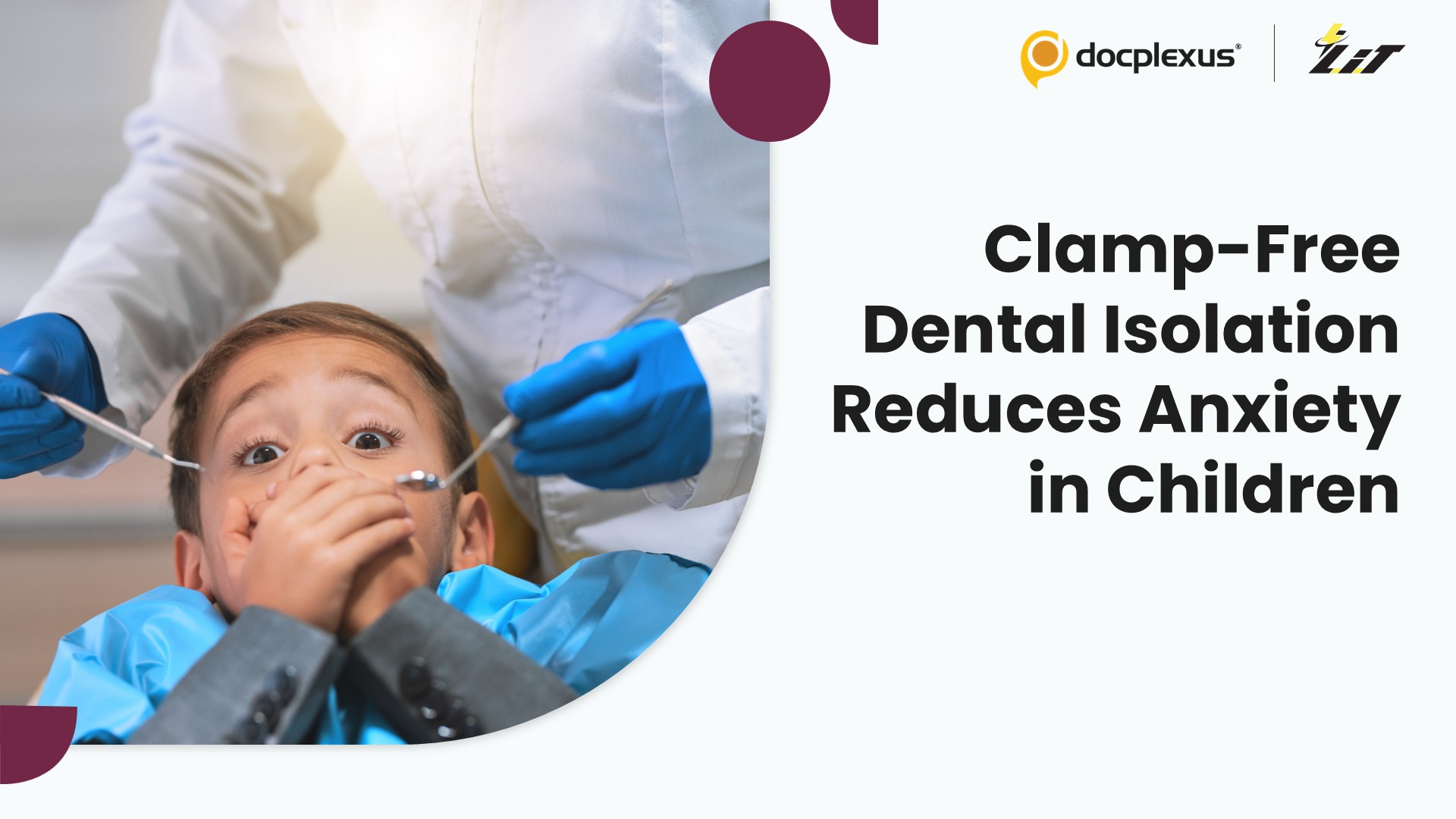 OptraDam Reduces Anxiety and Physiological Stress During Pediatric Pulpotomy