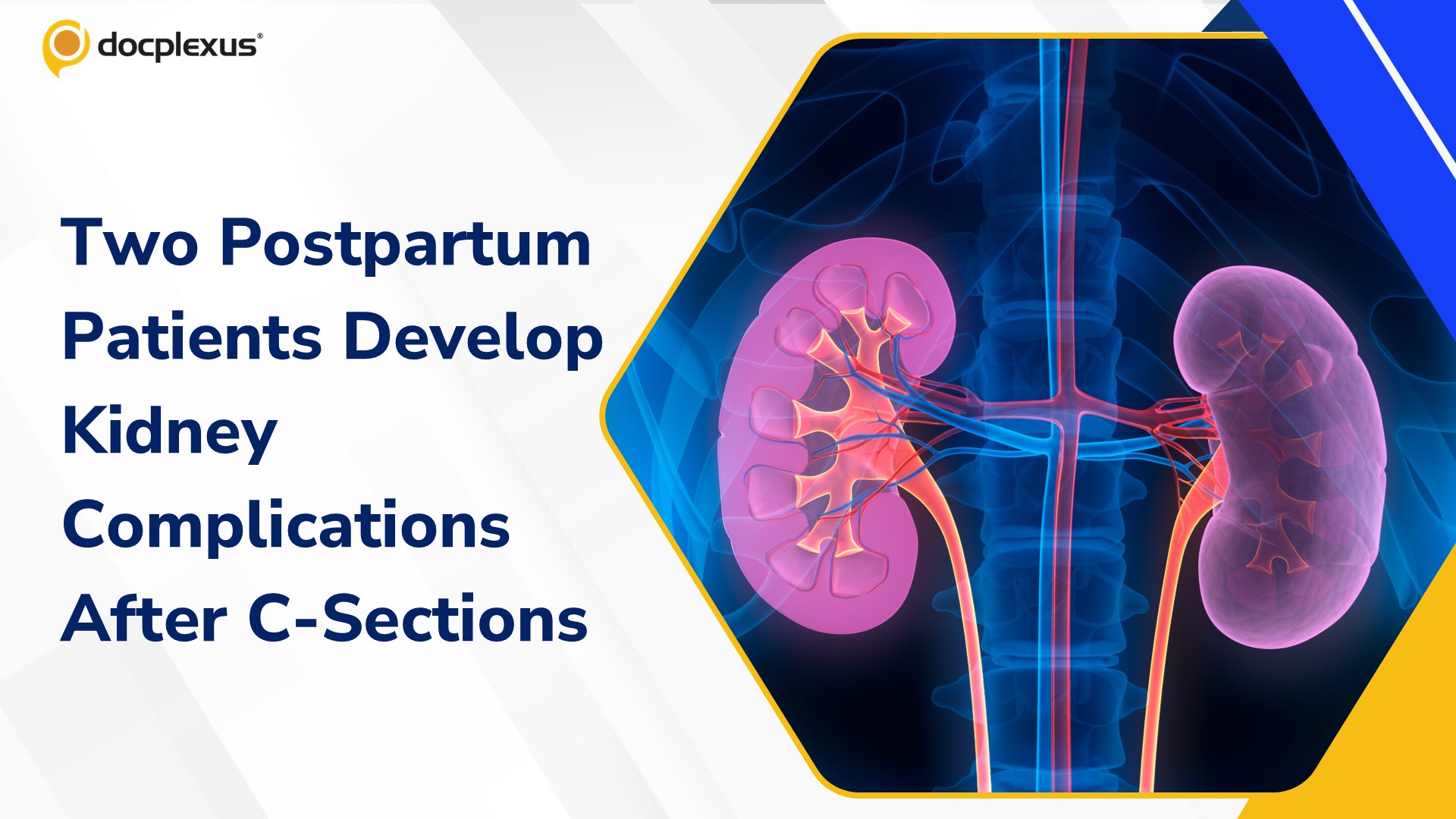 Two Women Develop Kidney Complications After Cesarean Deliveries at Rajasthan Medical College Hospital