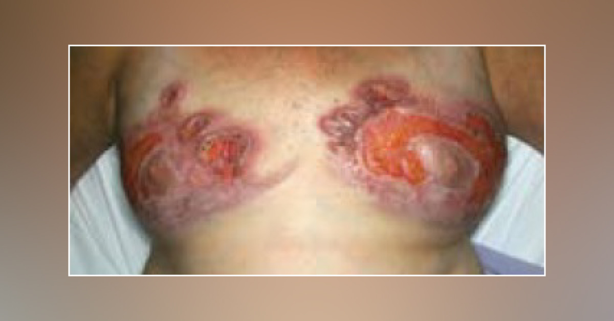 It All Began After Surgery