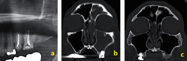 Docplexus