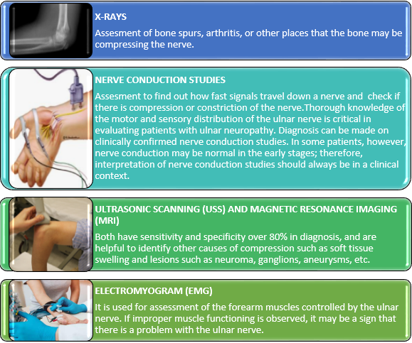 Cubital Tunnel Syndrome