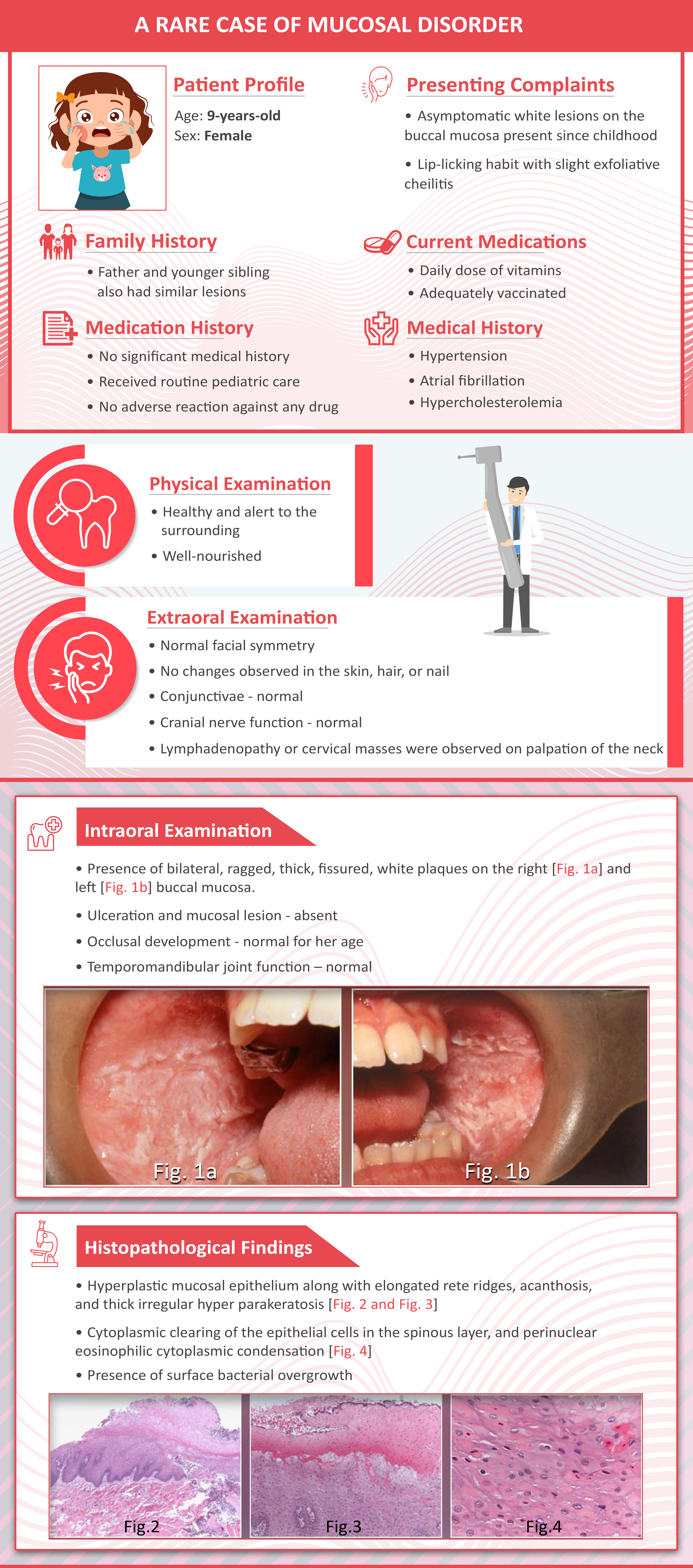 A Rare Case Of Mucosal Disorder