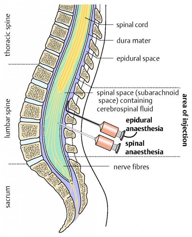 Myth Busters On Spinal Anaesthesia