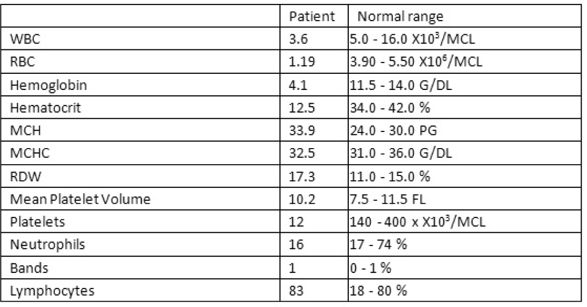 Young Child With Short Stature, Hypoplastic Thumb And Pancytopenia