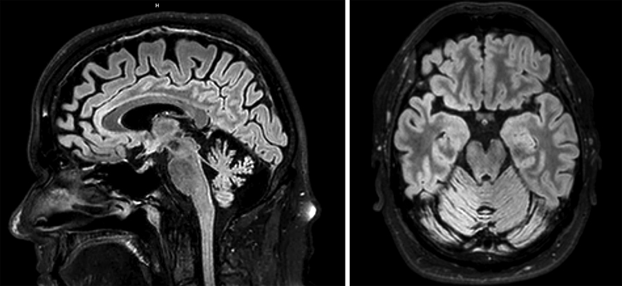 Diagnosis The Condition In This 43-Year-Old Man