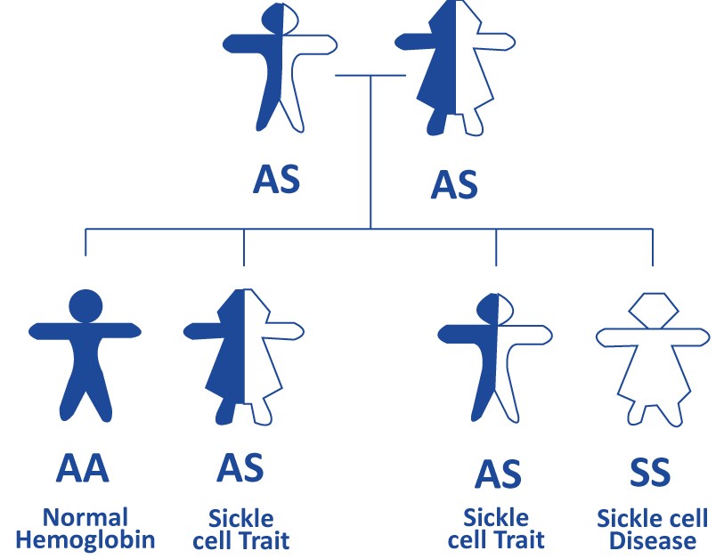 sickle cell anemia inheritance